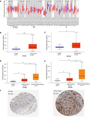 The genetic and epigenetic regulation of CD55 and its pathway analysis in colon cancer